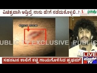 Bhuvan Ponnappa's First Comments About Being Bitten By Pratham