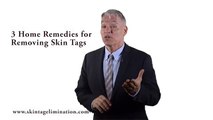 Easy and Painless home remedy for getting rid of skin tags FAST