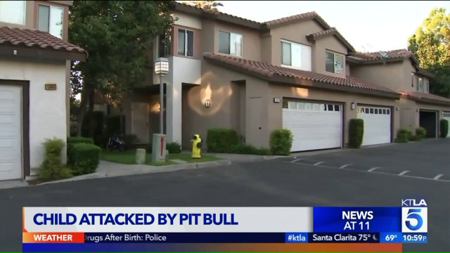 `He Mauled His Face:` Eight-Year-Old Boy Suffers Serious Bite Injury After Dog Attacks Him