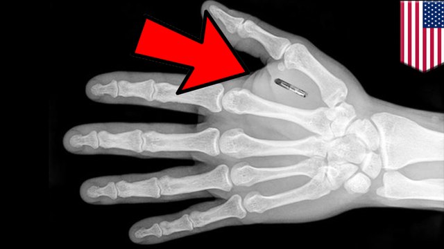 Software company implants microchips in employees' hands