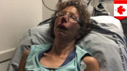 Hit-and-run on Canadian cyclist gets Facebook really mad