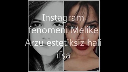 INSTAGRAM FENOMENİ MELİKE ARZU ESTETİKSİZ İFŞA