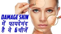 Damaged Skin Care | Beauty Tips | इन ची़जों से ठीक करें क्षतिग्रस्त त्वचा | Boldsky