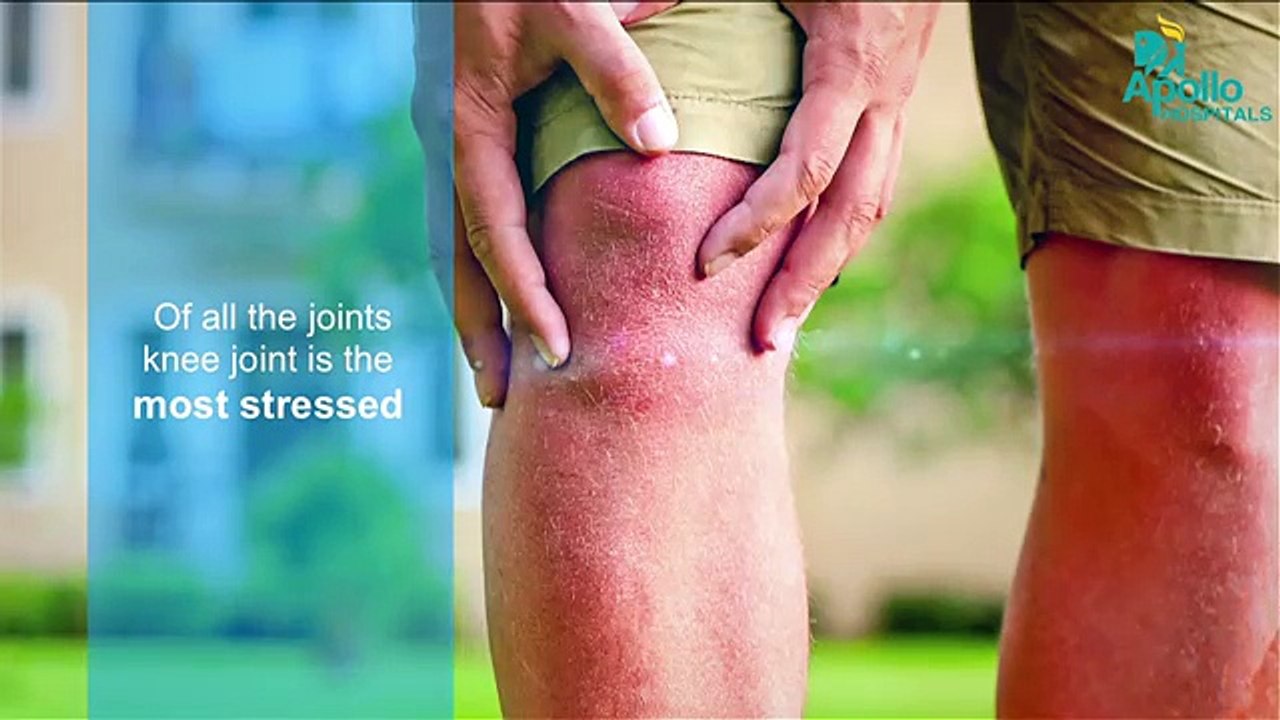 Do you really need a knee replacement? Here’s the answer
