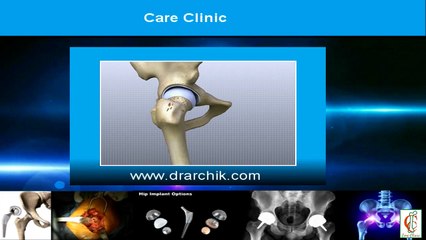 Hip Replacement Surgery in Mumbai With Orthopedic Surgeon Dr. Shreedhar Archik