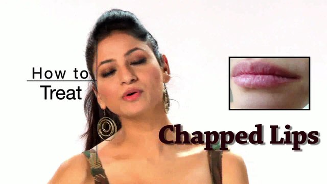 Chapped Lips Remedies