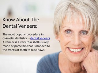 Know About Dental Veneers.