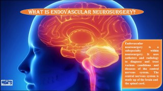 What is Endovascular Neurosurgery