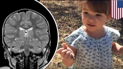 Toddler's brain damage reversed using oxygen treatments