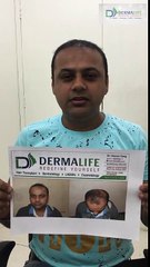 DermaLife Skin Care & Hair Transplant Clinic results after Hair Transplant  10