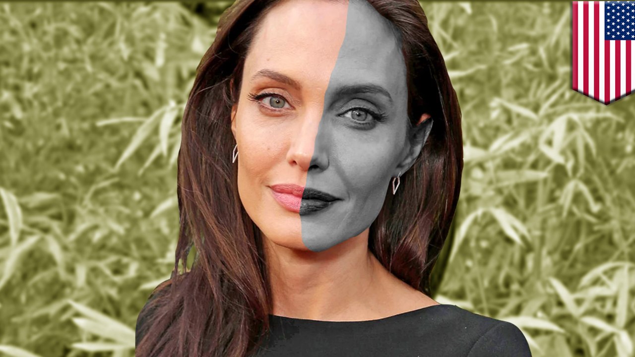 Angelina Jolie's rare facial paralysis explained