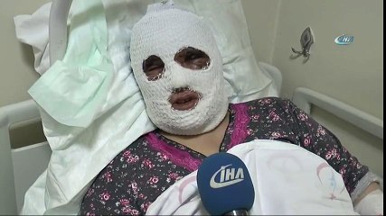 Temizlik Yaparken Dikkatsizlik Kadını Bu Hale Getirdi