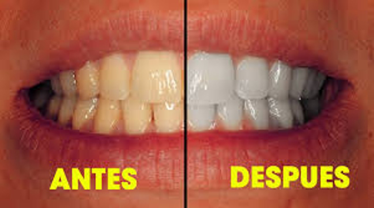 Di adiós a dientes amarillos, (Método: fácil, rápido, y gratis)