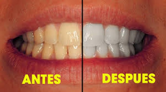 Di adiós a dientes amarillos, (Método: fácil, rápido, y gratis)