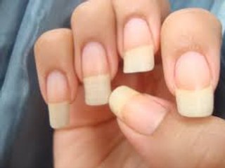 Cuidar las uñas de forma natural, (METODO- Rápido, fácil, y practicamente GRATIS).