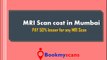 MRI Scan cost in Mumbai - PAY 50% lesser for any MRI Scans