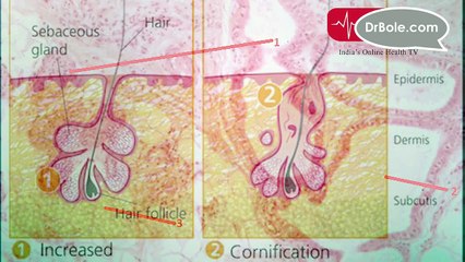 Skin Pores - Identify Your Skin