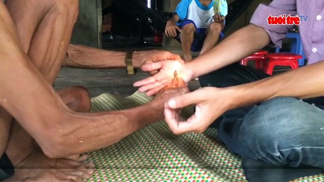 Thầy bói chữa bệnh bằng lửa trừ “tà ma” ở Quảng Ngãi