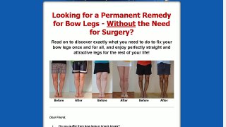 Bow Legs No More