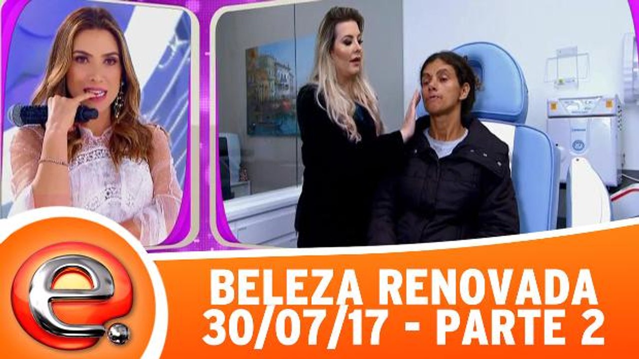 Beleza Renovada - 30.07.17 - Parte 2