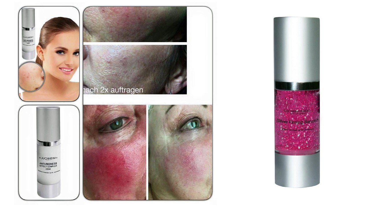 Couperose und besenreiser - wie richtig behandeln?