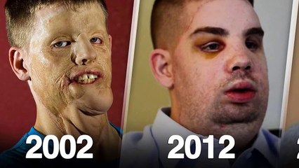 اسهتزئو به لان شكله قبيح"لكن شاهد كيف اصبح بعد ٥ سنوات" جعلهم يندمون"..!!