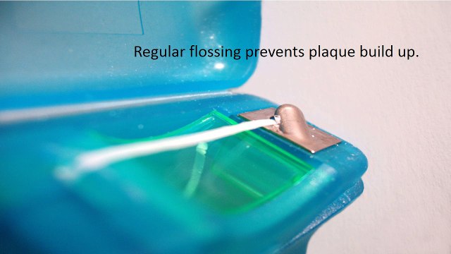 Dentist in Mansfield Ohio Call Now 419 777 5325