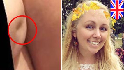 Breast cancer: Mom posts photo online to highlight uncommon breast cancer warning sign