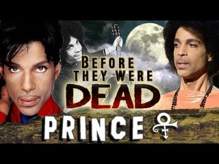 PRINCE - Before They Were DEAD - Prince Rogers Nelson