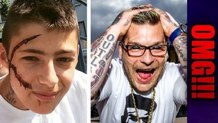 Chciał wyglądać jak jego IDOL  5 Najdziwniejszych operacji, które ryją beret xD