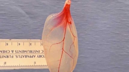 Biomédecine : des plantes pour la greffe de tissus humains ?