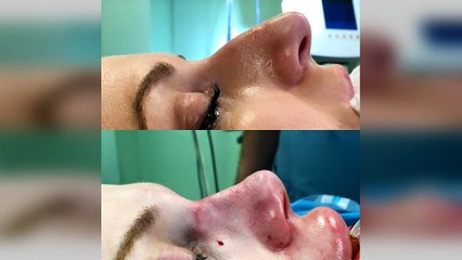 Spitali Amerikan kirurgjia plastike