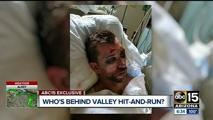 Driver leaves after badly injuring motorcyclist who can't remember crash