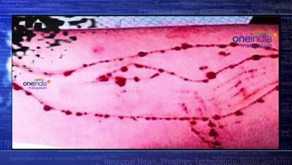 ആളെക്കൊല്ലി ഗെയിം, ബ്ലൂവെയില്‍ ചലഞ്ച് കേരളത്തില്‍ ഡൌണ്‍ലോഡ് ചെയ്തത് 2000 പേര്‍ | Oneindia Malayalam