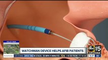 Watchman Device: Quarter-sized device helps reduce stroke risk for atrial fibrillation patients