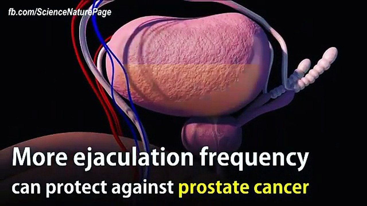 Frequent ejaculation can prevent prostate cancer.