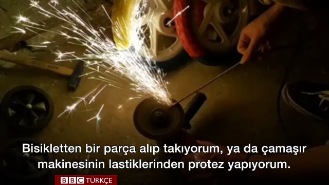 Yürüyemeyen Hayvanlara Özgürlük Hediye Eden Genç