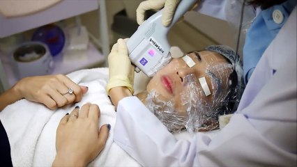 Trẻ hoá xoá nếp nhăn bằng công nghệ Hifu