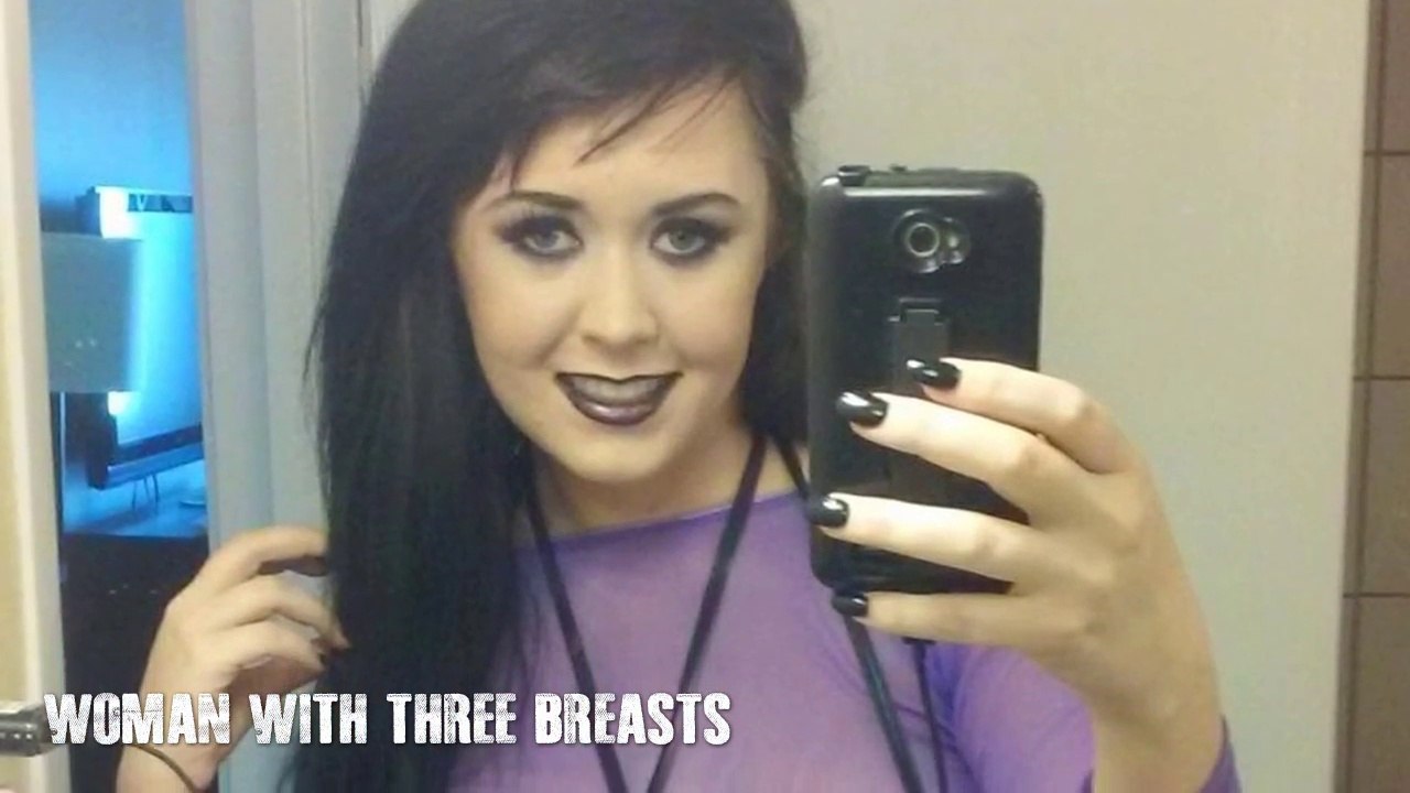 5 People With Extra Body Part