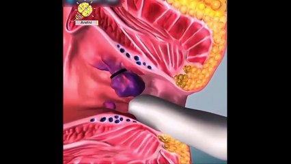 Watch How A Doctors Perform Surgery ★ Hair Transplant | Hemorrhoid | Teeth Implants