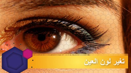 أغرب عمليات التجميل في العالم