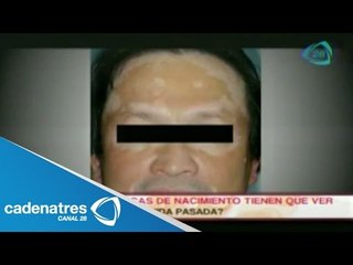 ¿Las marcas del nacimiento hablan de nuestra vida pasada?