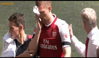 Per Mertesacker Get Horror Injury HD - Arsenal 0-0 Chelsea 06.08.2017