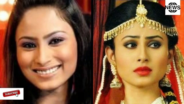 Naagin 3 Actress Mouni Roy Transform By Plastic Surgery Of Lips