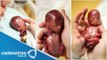 Impactantes fotografías del bebé de tan solo 19 semanas de gestación
