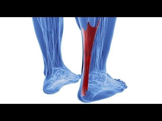 ¿Cómo atender un desgarre muscular?