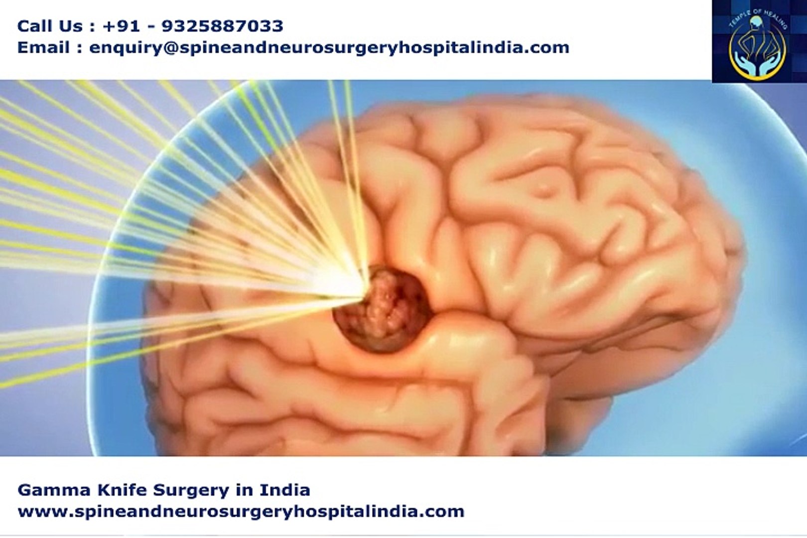 Gamma Knife Surgery In Mumbai Advanced Radiotherapy At Affordable Cost In India - 