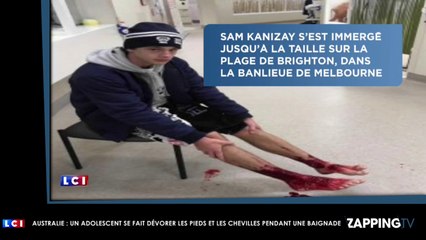 Australie : Un adolescent se fait dévorer les pieds pendant une baignade (Vidéo)