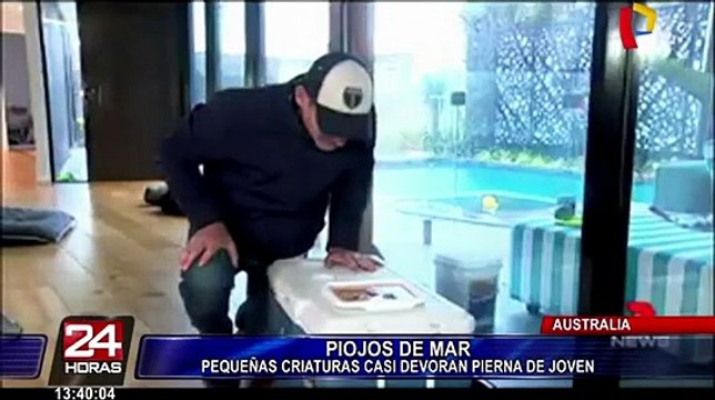 [VIDEO] Australia: Estos pequeños animales casi se comen pies de un joven bañista