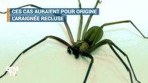 A quoi ressemble l'araignée recluse?